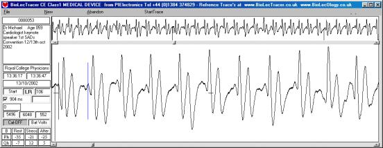 Ref-Trace